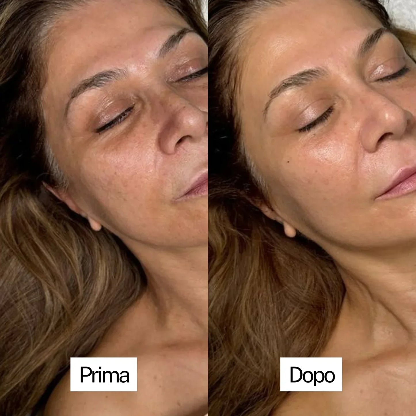 Maschera al Bio-Collagene (versione liquida)